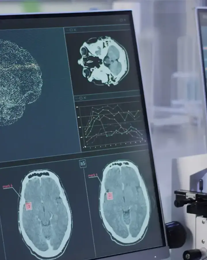 microscope with monitors