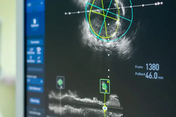 screen with scan results