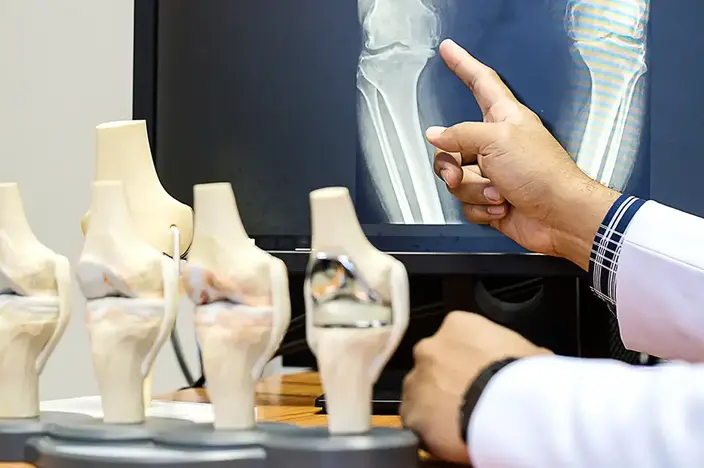 doctor with x-ray and plastic joint models